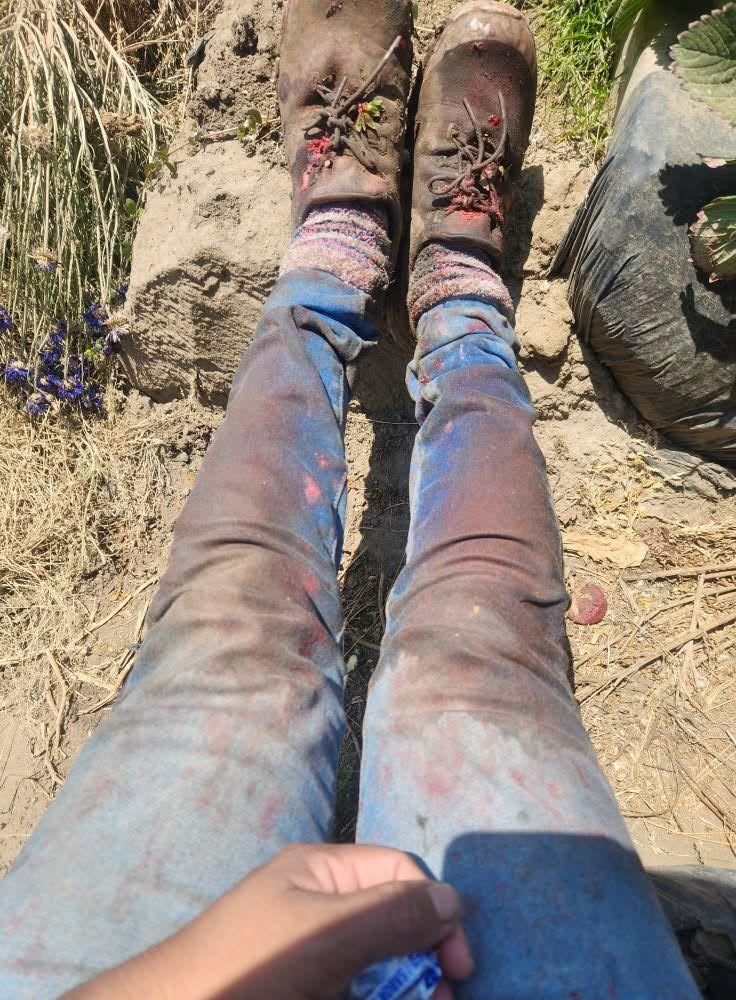 A farm worker resting of strawberry picking. Her pants are discolored with strawberry stains
